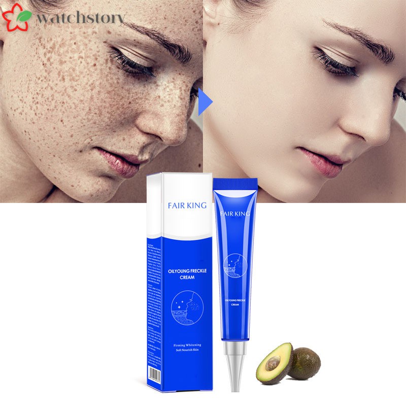 (Hàng Mới Về) Kem Trị Tàn Nhang Vết Thâm Làm Trắng Da 20g | BigBuy360 - bigbuy360.vn