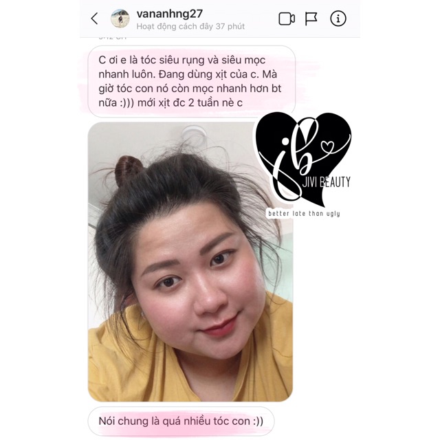 XỊT KÍCH MỌC TÓC GIẢM RỤNG | BigBuy360 - bigbuy360.vn