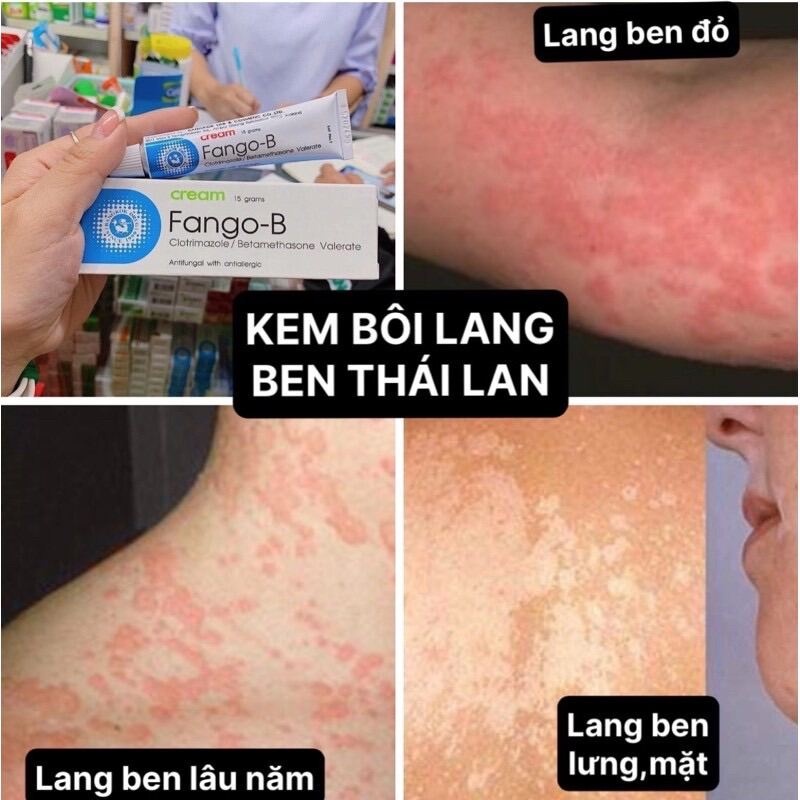 Kem bôi lang ben, nấm ngứa Fango-B CREAM Thái Lan