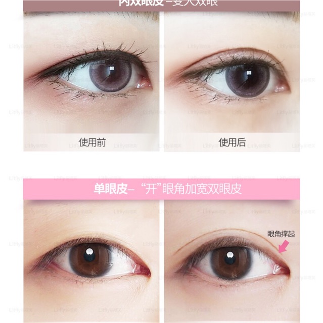 kích mí lưới:hộp 120 cặp,hàng sẵn keo