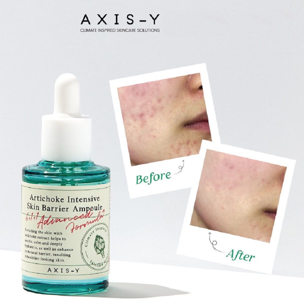 Tinh Chất Phục Hồi Sâu Cho Da AXIS-Y Artichoke Intensive Skin Barrier Ampoule 30ml