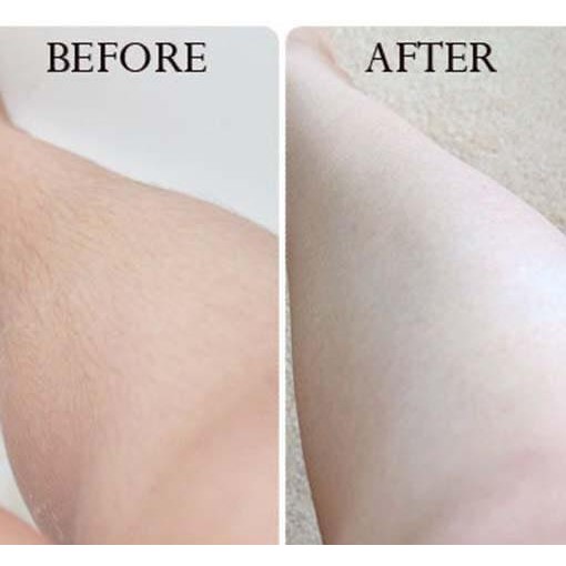 Kem tẩy lông VEET HAIR REMOVAL CREAM