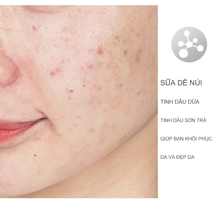 Xà Phòng Sữa Non Dê Núi Nguyên Chất | BigBuy360 - bigbuy360.vn