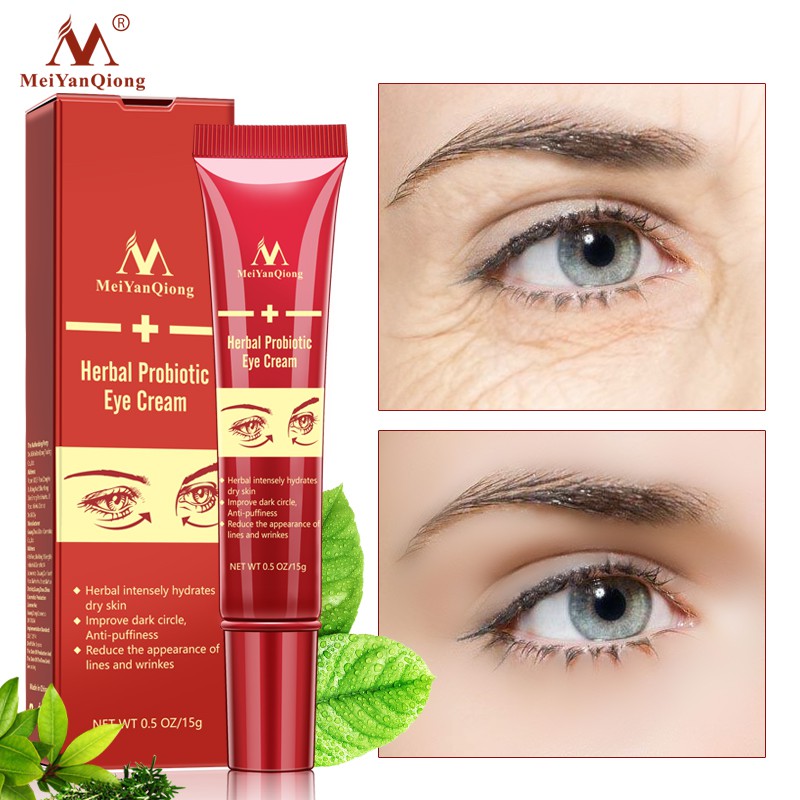 Kem dưỡng da mắt MeiYanQiong chống nếp nhăn xóa mờ quầng thâm dưỡng ẩm trắng da 15g | BigBuy360 - bigbuy360.vn