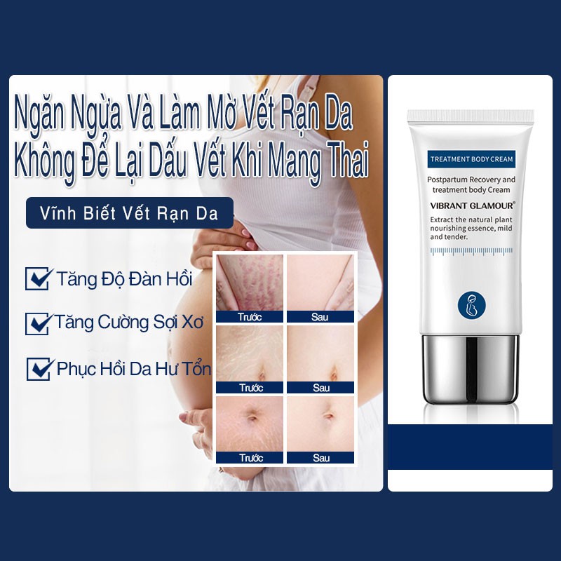 KEM LÀM MỜ RẠN DA SAU SINH & SẸO TÁI TẠO DA LÀM MỜ SẸO VIBRANT GLAMOUR