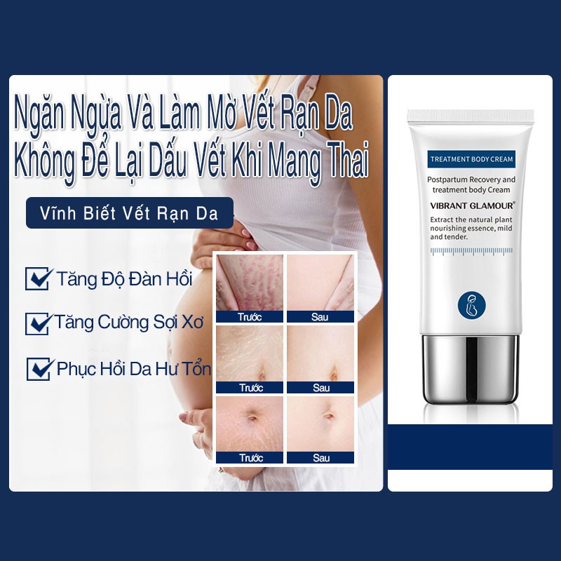 [Hàng Chính Hãng] VIBRANT GLAMOUR KEM LÀM MỜ RẠN DA SAU SINH & SẸO TÁI TẠO DA LÀM MỜ SẸO 30g