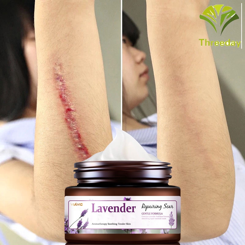 3D❤ Scar Removal Cream Lavender Cream Skin Care Natural Remove Burn Stretch Marks Ointment