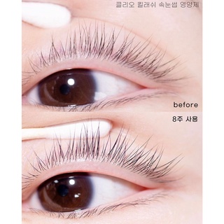 [HOT NEW]Tinh Chất Dưỡng Mi CLIO Kill Lash Eye Serum
