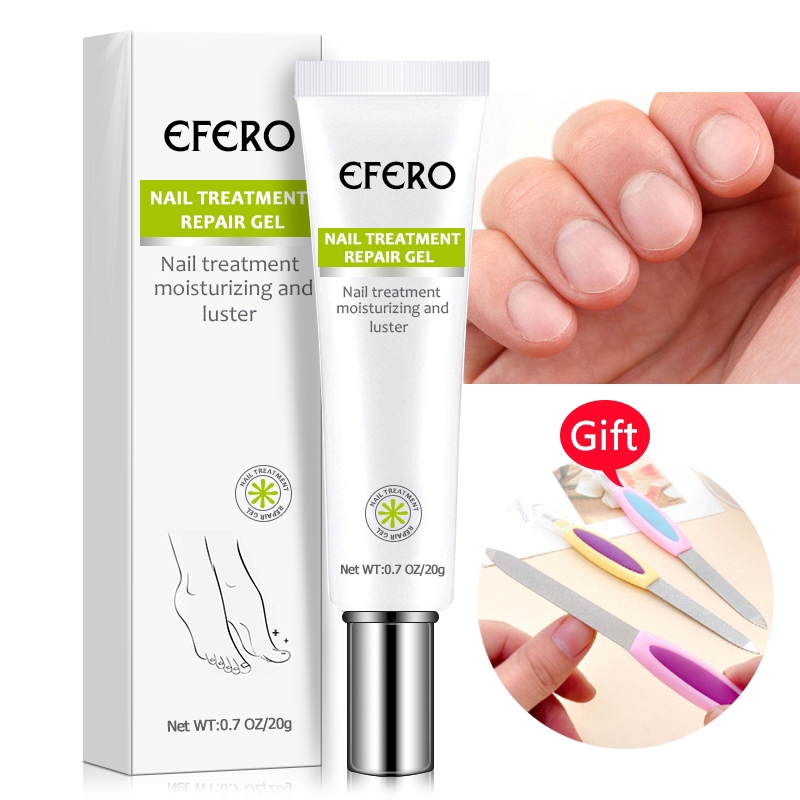 [Hàng mới về] Serum dưỡng loại bỏ nấm móng chân móng tay chống nhiễm trùng
