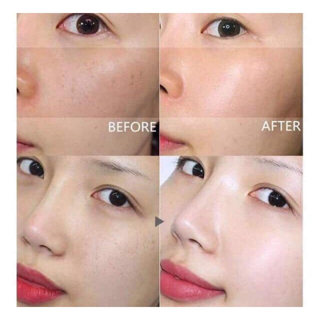 Nước hoa hồng Hàn Quốc dưỡng trắng, giảm nám hiệu quả Dongsung Rannce Skin 130ml