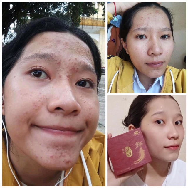 CAO 〽️ỤN SÂM ĐỎ 36 VỊ - MEEA ORGANIC | BigBuy360 - bigbuy360.vn