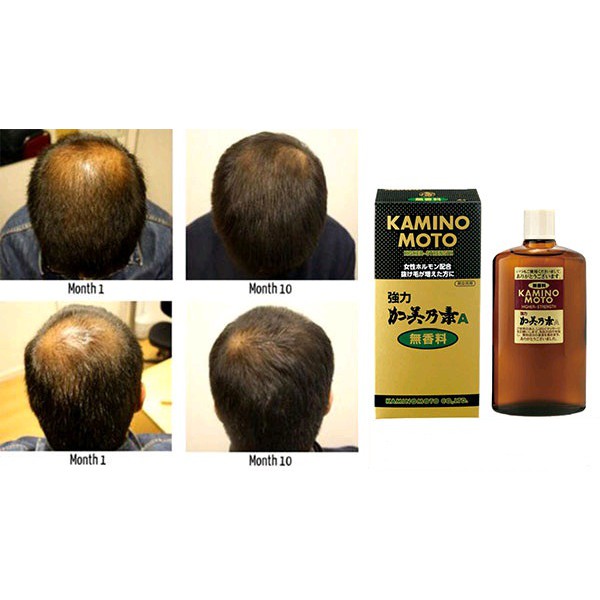 Serum kích thích mọc tóc Kaminomoto Higher Strength 200ml nội địa Nhật