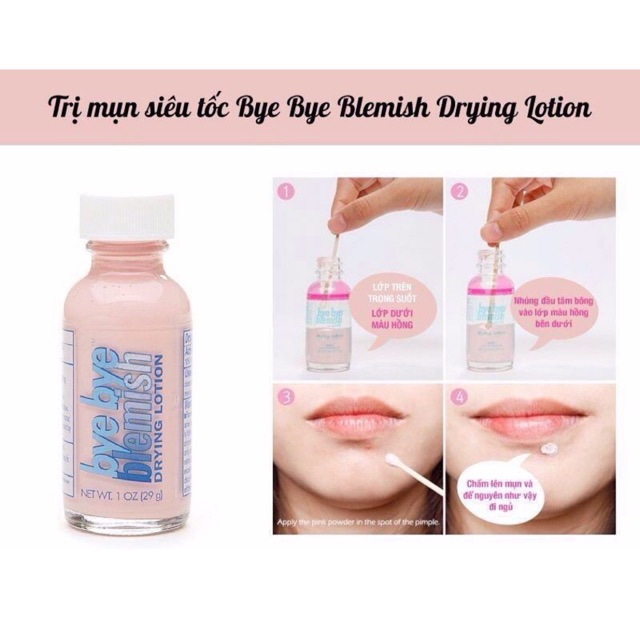 Chấm ngăn ngưa mụn Bye bye Blemish Drying Lotion