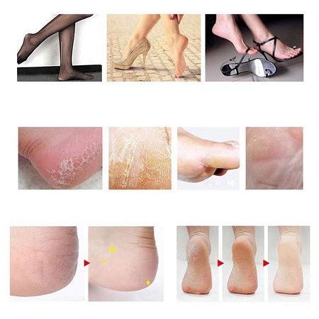Chà Gót Chân, Bộ 10/10 Dụng Cụ Chăm Sóc Bàn Chân Và Tẩy Tế Bào Chết Dành Cho Nam Và Nữ ( kèm hôp nhựa )