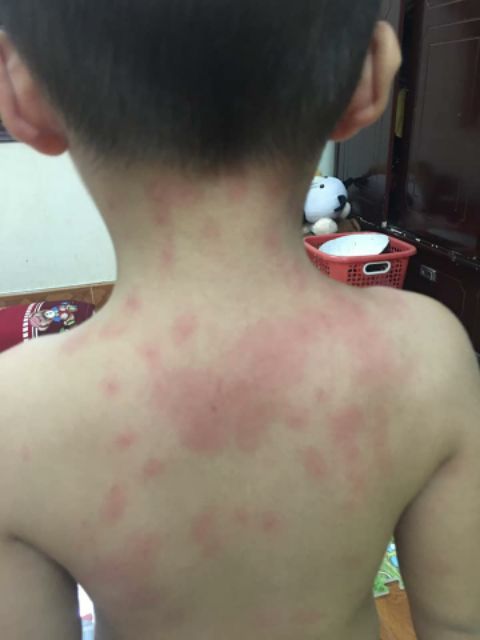 Tràm muối tắm thảo dược  CHÍNH HÃNG