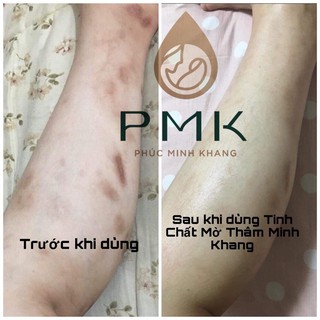 Tinh Chất Mờ Thâm Minh khang( tặng ngay 1 thâm gia truyền 120k)