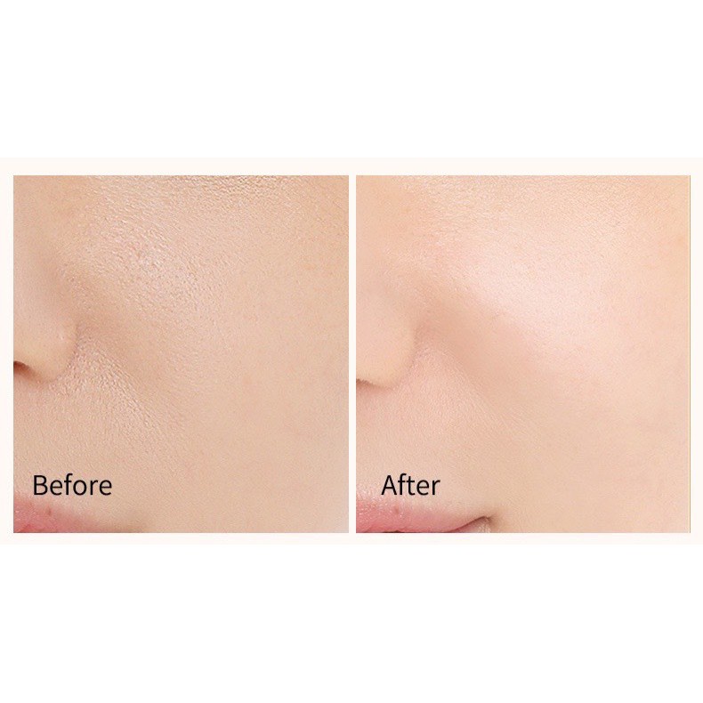 Tinh Chất Vitamin C đồng thời chứa chiết xuất cam thảo giúp Sáng Da Mờ Thâm mụn vào cải thiện sẹo thâm
