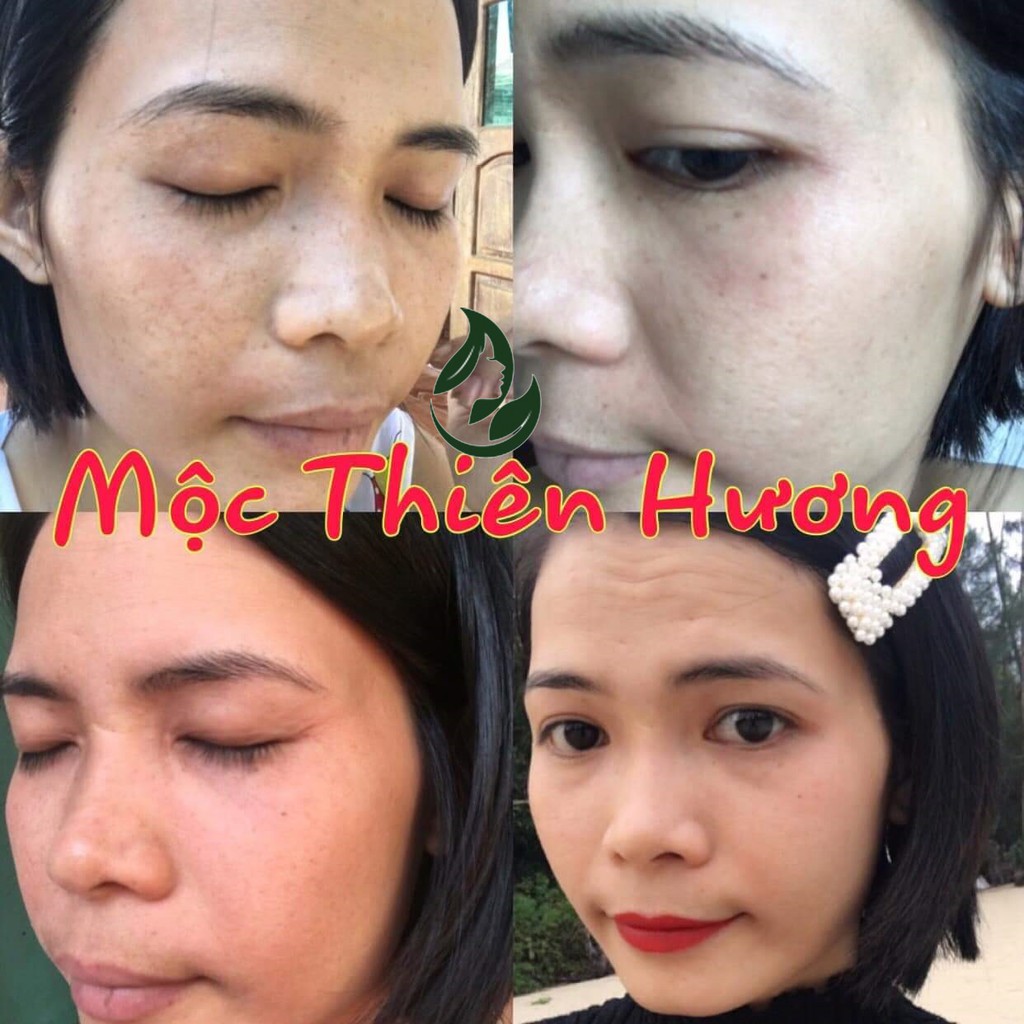 Combo Dành Cho Da Nám, Dưỡng Trắng Da Cấp Tốc Mộc Thiên Hương | BigBuy360 - bigbuy360.vn