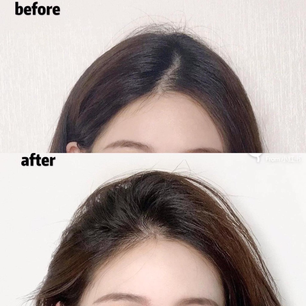 Xịt Dưỡng Tóc Hairburst Volume And Growth Elixir Chiết Xuất Bơ &amp; Dừa 125ml