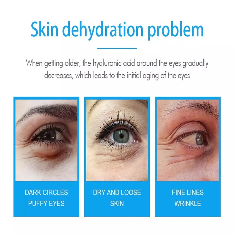 Mặt nạ mắt LEWEDO axit hyaluronic chống lão hóa dưỡng ẩm làm săn chắc 80g