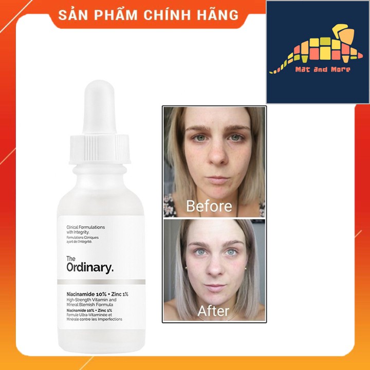 [CHÍNH HÃNG] Tinh chất Niacinamide 10% + Zinc 1% - The Ordinary