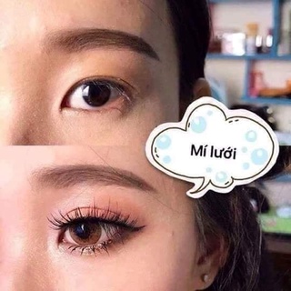 Keo dán mí lưới