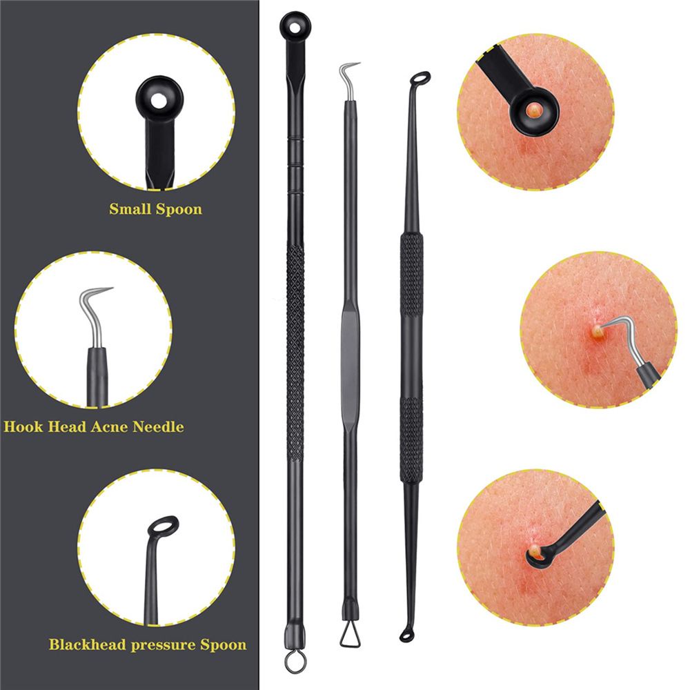 [Hàng mới về] Set dụng cụ loại bỏ mụn đầu đen hai đầu bằng thép không gỉ chăm sóc da có hộp đựng dành cho nữ