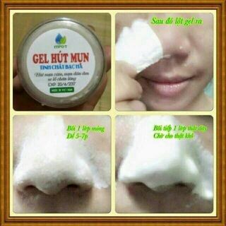 GEL HÚT MỤN TINH CHẤT BẠC HÀ