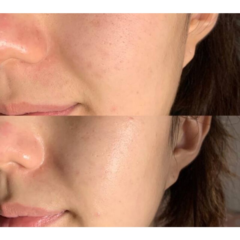 Kem dưỡng A’PIEU MADECASSOSIDE