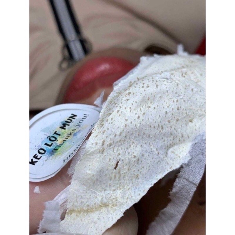 Gel Lột Mụn Đầu Đen Handmade, Keo Lột Mụn Cám Làm Sạch Sâu Hỗ Trợ Giảm Mụn Cho Vùng Mũi