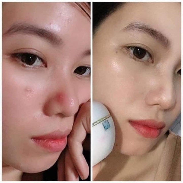 Kem face truyền trắng mụn Mwhite (cam kết chính hãng)