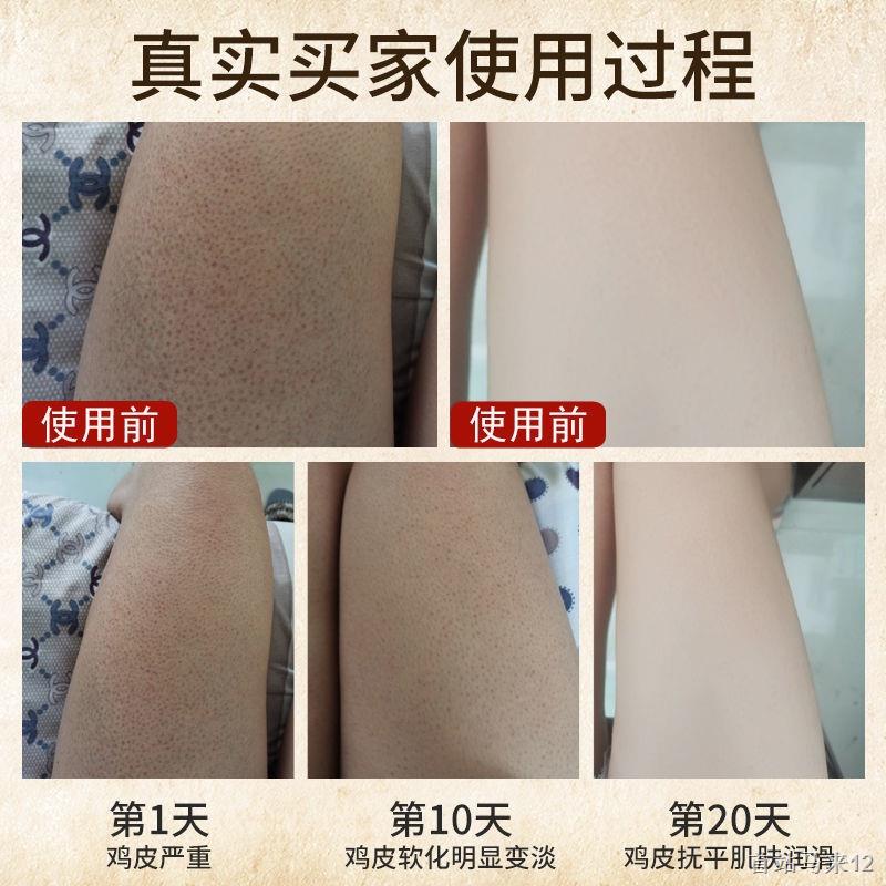 Kem Dưỡng Thể Làm Trắng Da Mùa Đông Dạng Ống Hút Dưỡng Ẩm Loại Bỏ Da Gà Lâu Trôi Có Hương Thơm hl21.10.8 szmalai12.my