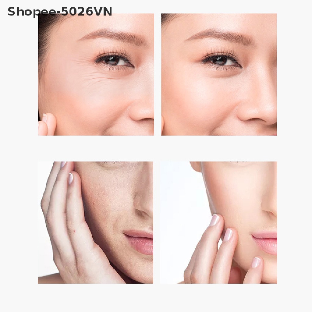 [Hàng mới về] 5 Túi Mặt Nạ Chống Nếp Nhăn Vùng Mắt Vùng Trán
