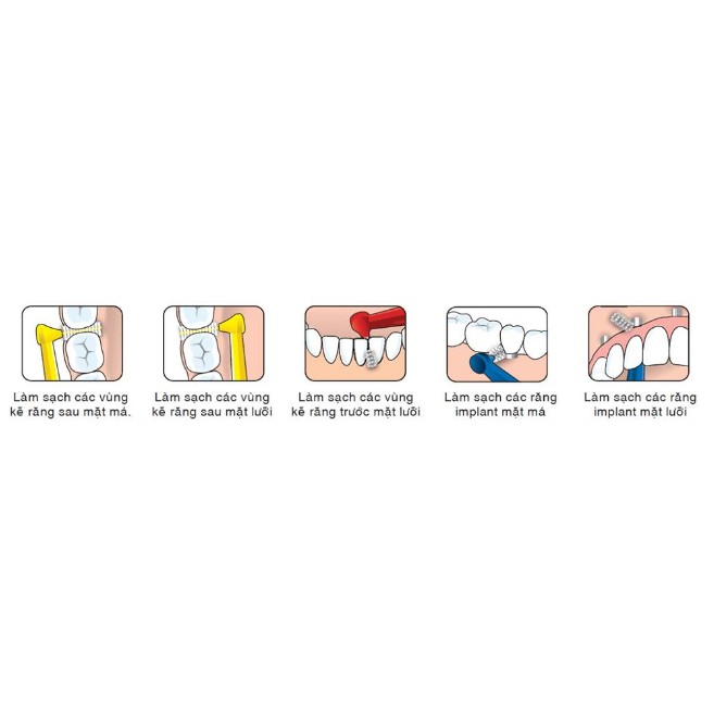 Bàn Chải Kẽ Răng Góc Tepe