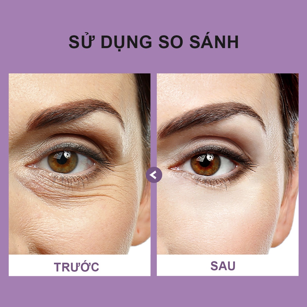 Kem Dưỡng Da Mắt Youngbook Chống Lão Hóa Giảm Nếp Nhăn Dưỡng Ẩm Và Nuôi Dưỡng Da Khô 15g | BigBuy360 - bigbuy360.vn