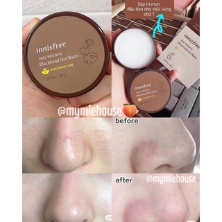 VOLCANIC BLACK HEAD OUT BALM - sáp loại bỏ mụn đầu đen