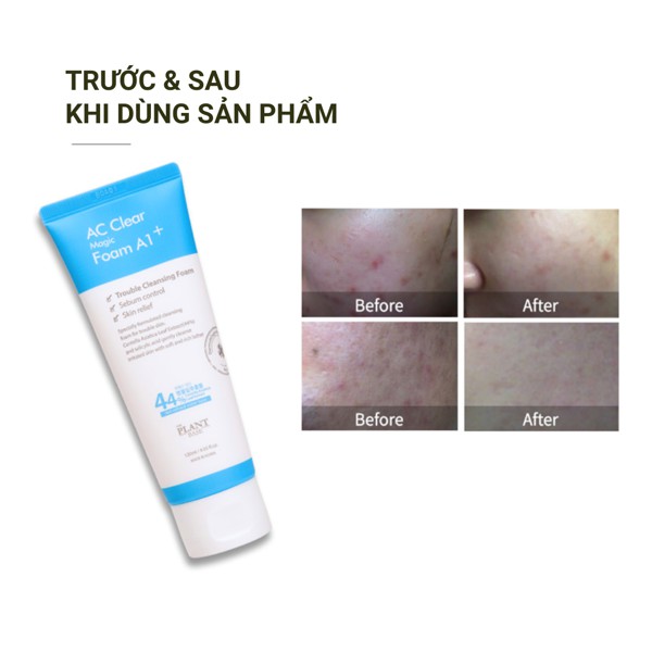 Sữa rửa mặt da dầu mụn THE PLANT BASE AC Clear Magic Foam A1+ 120ml