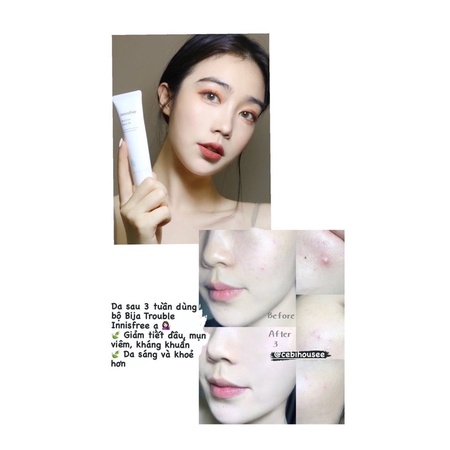 Kem dưỡng làm dịu da Bija Cica Gel EX và Cica Balm EX