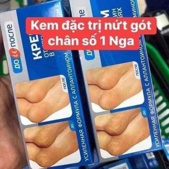 Kem trị nứt gót chân Kpem của Nga