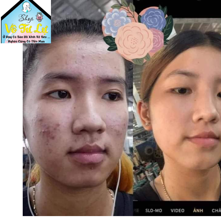Kem Face Ngọc Oanh🥰hàng mới🥰  . hàng chính hãng tận gốc