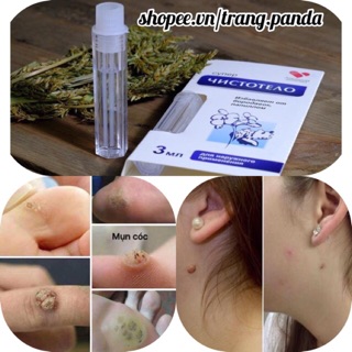 Tẩy nốt ruồi mụn cóc Nga