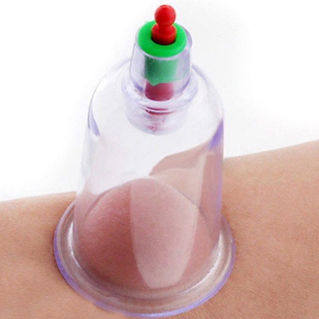 Bộ Giác Hơi 12 Món Không Dùng Lửa