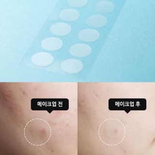Miếng dán mụn Olive Young CarePlus