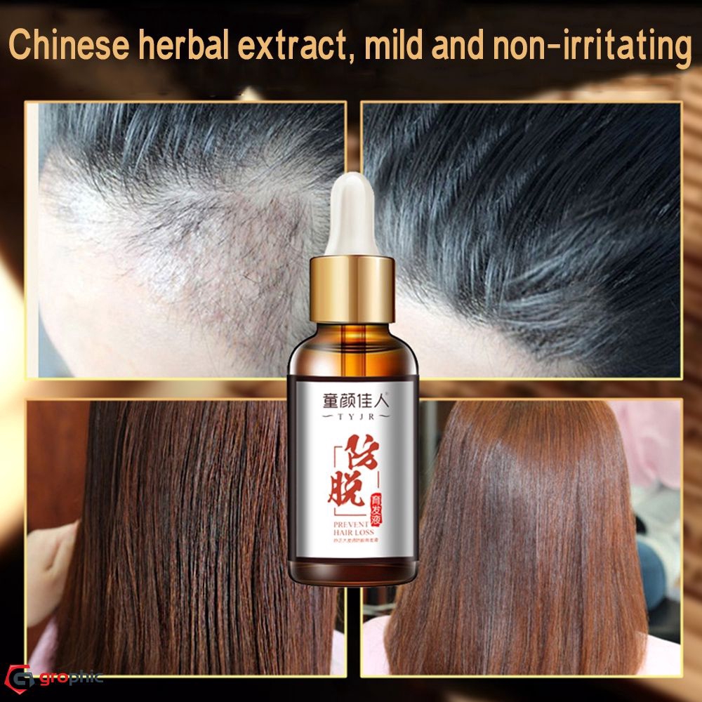 [Hàng mới về] Thuốc dưỡng tóc chống rụng tóc dung tích 30ml