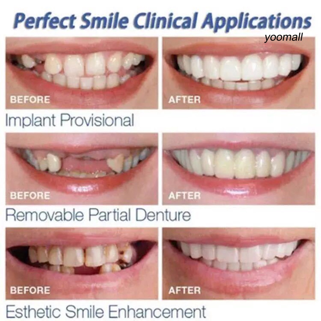 [Hàng mới về] Bộ 2 hàm răng giả tự nhiên chất lượng cao chuyên dụng