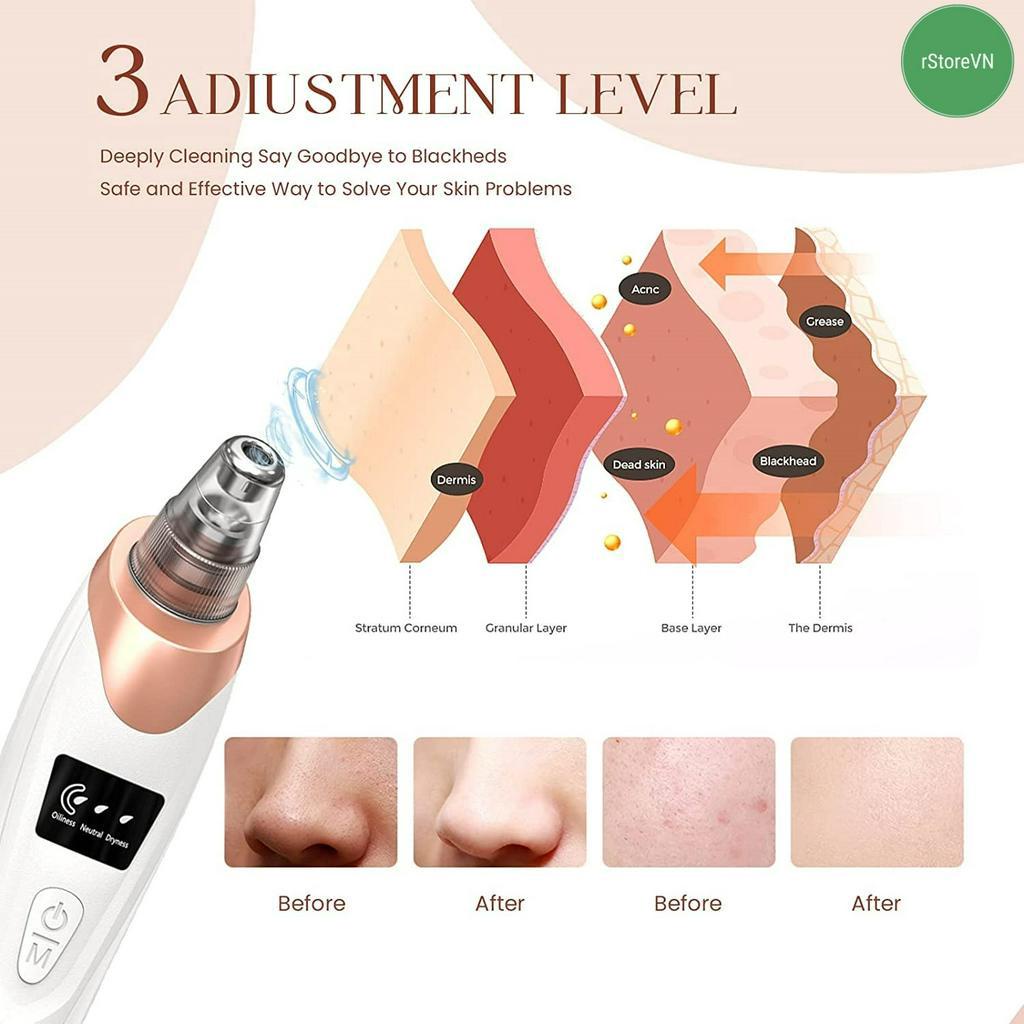 Máy Hút Mụn Đầu Đen HY9 - Mini Cầm Tay, Màn Hình LED, 5 Đầu Hút Cực Mạnh - Hàng Chính Hãng