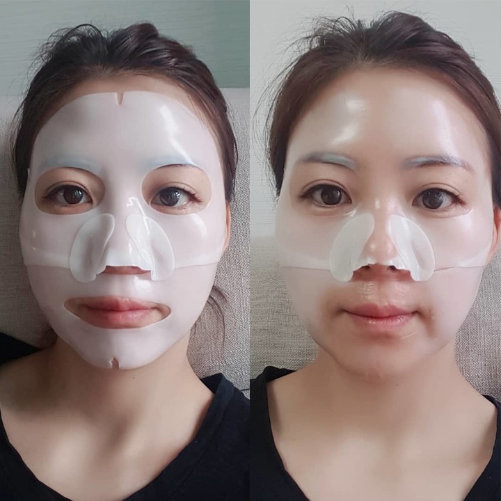 Mặt Nạ Derm All Matrix Hàn Quốc, Mặt Nạ Thạch Collagen Mask Derm All Matrix Dưỡng Da Trắng Sáng Căng Bóng Hộp 4 Miếng