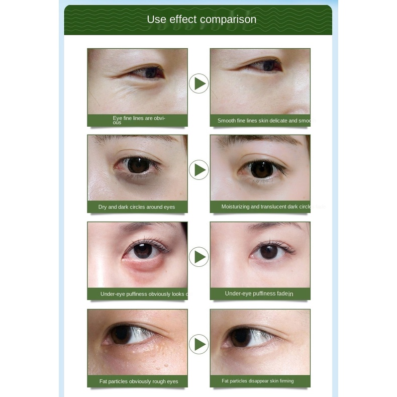 Tinh dầu dưỡng ẩm làm sáng da mắt loại bỏ quầng thâm | BigBuy360 - bigbuy360.vn