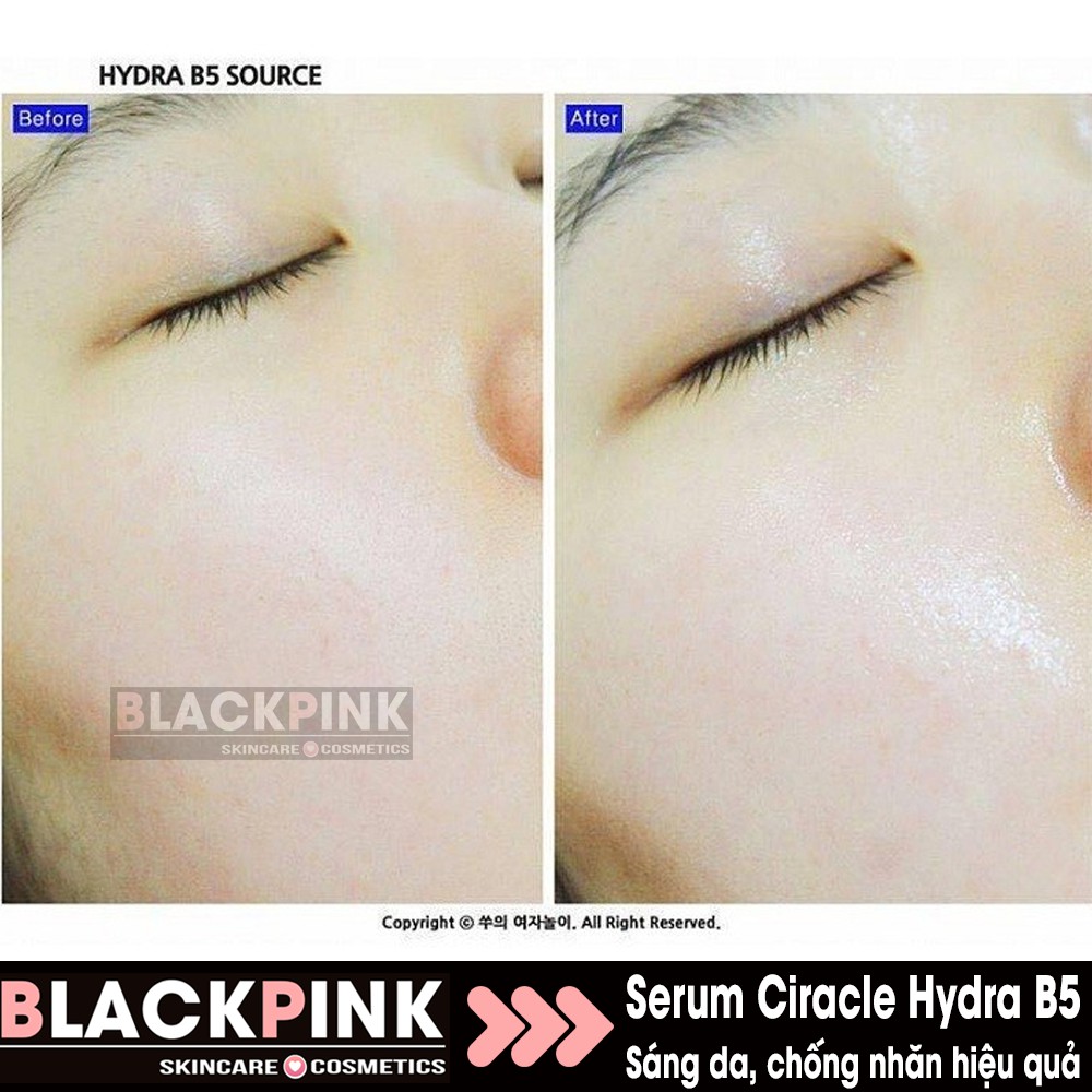 Tinh Chất Dưỡng Da Ciracle Hydra B5 Source Wrinkle B5 - Sáng da và chống nhăn hiệu quả