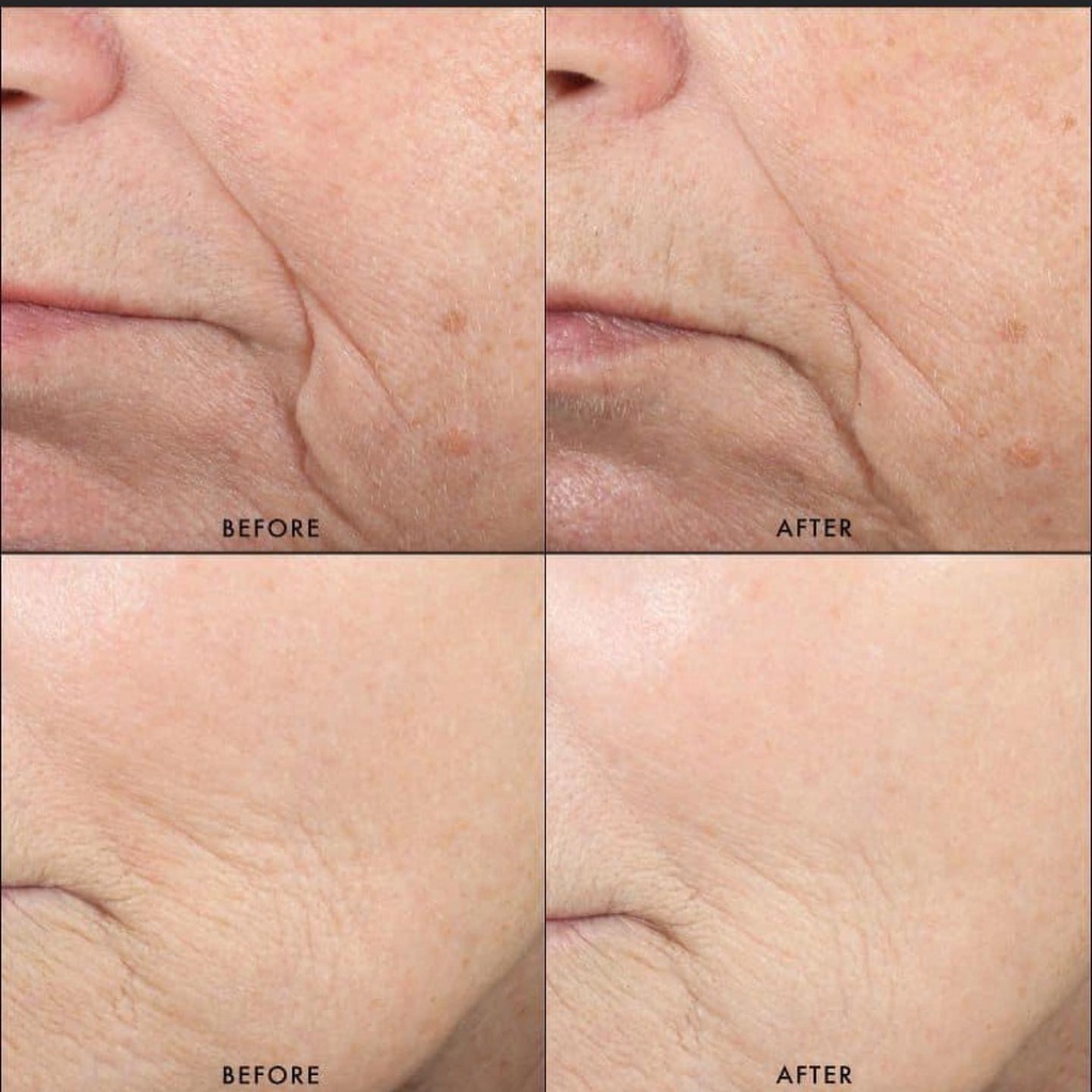 Kem Dưỡng Da Skin.Ceuticals Triple Lipid Restore 2:4:2 Mini 4ml